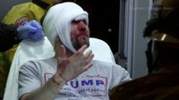 bloodied-trump-supporter.jpg