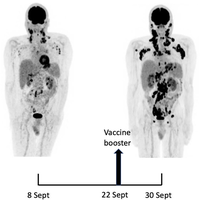 Alarming — risk of widespread cancer in mRNA-injected individuals